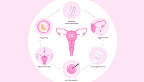 IVF Treatment Basics: Steps, Success Factors and Emotional Preparation