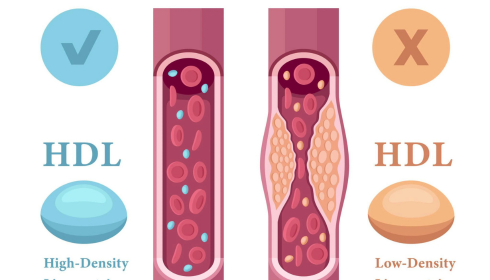 Understanding Cholesterol: HDL, LDL and Triglycerides in Simple Language
